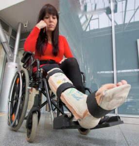X-ray of a broken leg – a common travel injury that raises concerns about flying safely